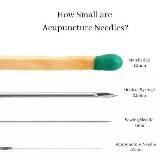 aqi-acupuncture-post-img3